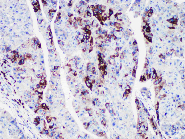 AFP Monoclonal Antibody (ELAB6919-R)