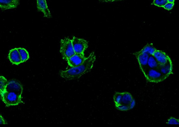 Recombinant E-Cadherin/CDH1/E-cad/CD324 Monoclonal Antibody (AN300023P)
