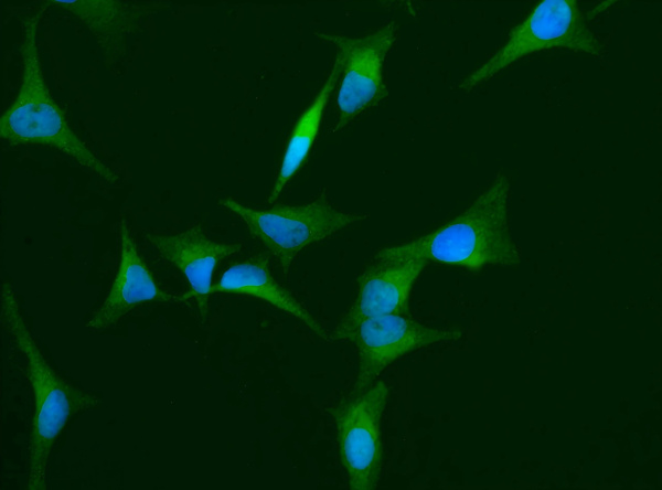 Hemopexin/HPX Monoclonal Antibody (AN200189P)