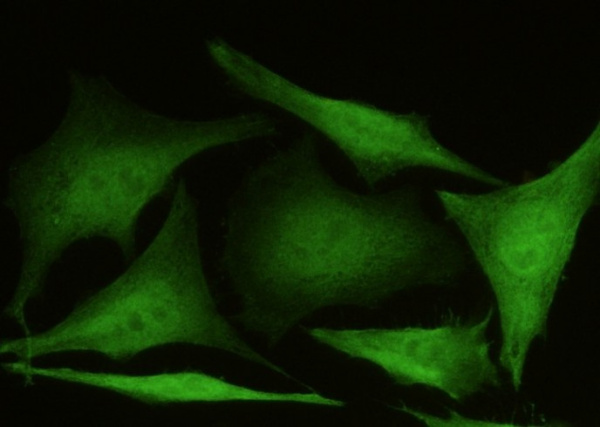 Recombinant AKR1B1 Monoclonal Antibody (AN300120P)