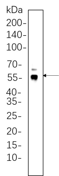 Recombinant ERG Monoclonal Antibody (AN300724L)