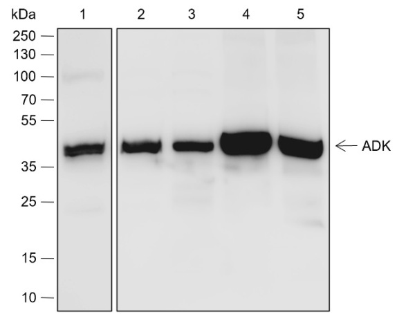 Recombinant ADK Monoclonal Antibody (AN301852L)