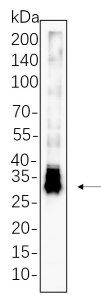 Recombinant DARPP-32 Monoclonal Antibody (AN300621L)
