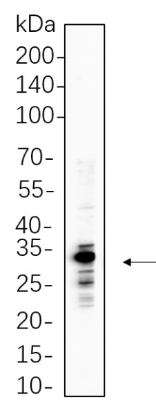 Recombinant ELNE Monoclonal Antibody (AN301296L)