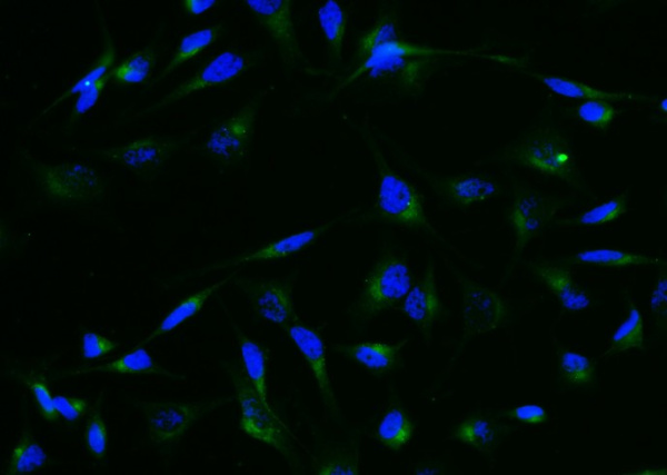 Granulin/GRN/Progranulin Monoclonal Antibody (AN200186P)