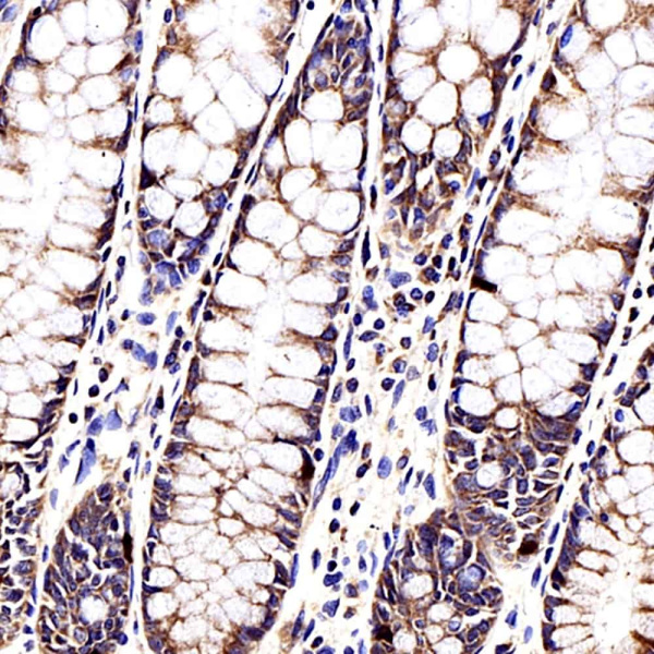 CCL2 Polyclonal Antibody (E-AB-70085)
