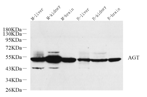 AGT Polyclonal Antibody (E-AB-70276)