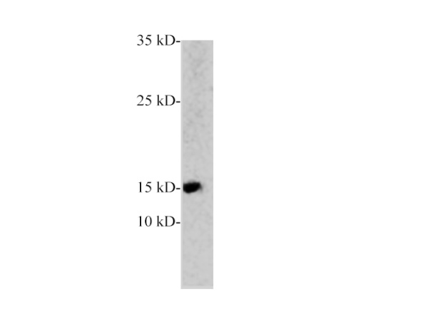 PCT Polyclonal Antibody (E-AB-40536)
