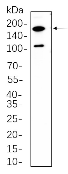 Recombinant Rictor Monoclonal Antibody (AN300699L)