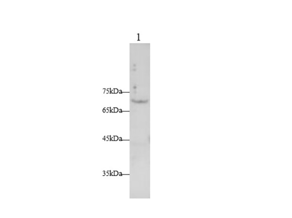TNFRSF21 Polyclonal Antibody (AN006810L)