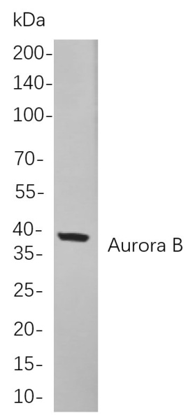 Recombinant Aurora B Monoclonal Antibody (AN300902L)