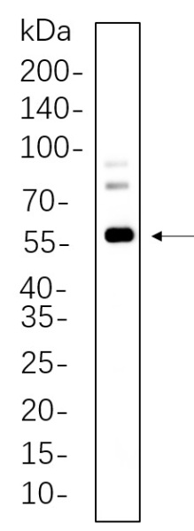 Recombinant c-Fos Monoclonal Antibody (AN301349L)