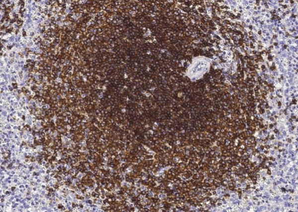 Recombinant CD22 Monoclonal Antibody (AN300016P)