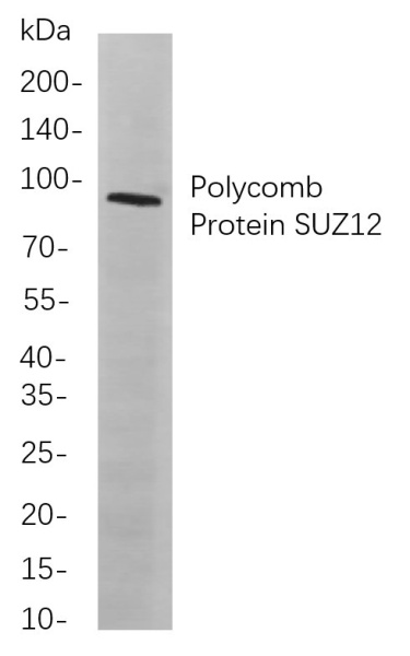 Recombinant Polycomb Protein SUZ12 Monoclonal Antibody (AN301049L)