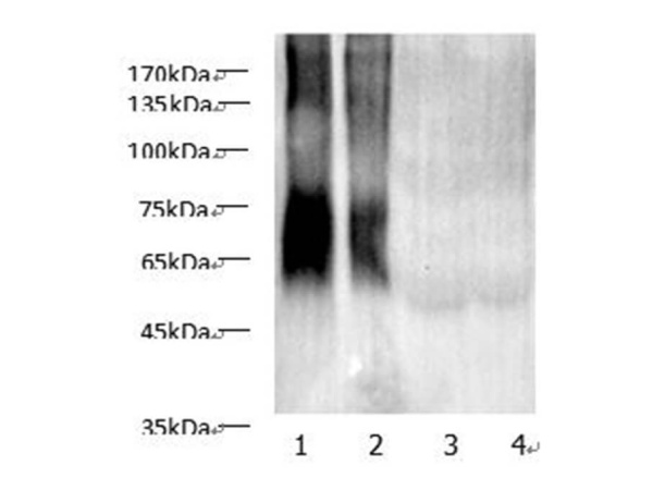 MAA Lysine Polyclonal Antibody (E-AB-40543)