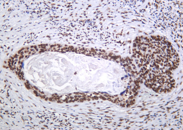 Recombinant Histone H4 (Acetyl Lys5) Monoclonal Antibody (AN301405L)