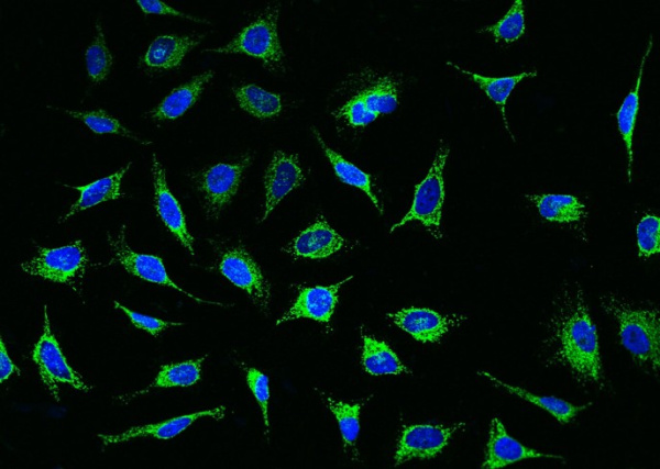 Recombinant PDHA1 Monoclonal Antibody (AN300453P)