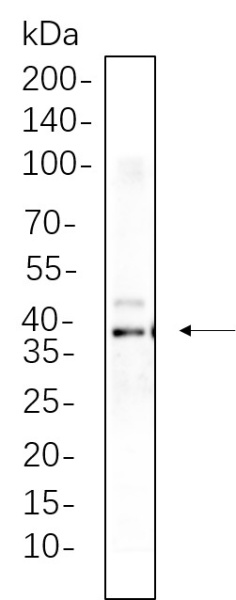 Recombinant Synaptophysin Monoclonal Antibody (AN300614L)