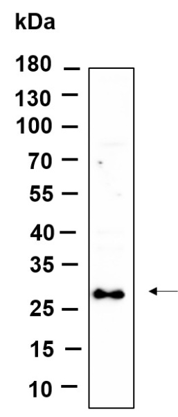 Recombinant SYPL1 Monoclonal Antibody (AN301210L)