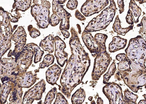 CD113/Nectin-3 Monoclonal Antibody (AN200188P)