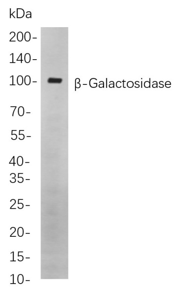 Recombinant β-Galactosidase Monoclonal Antibody (AN300905L)