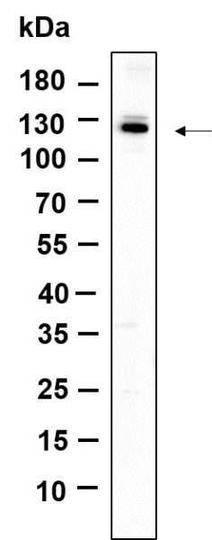 Recombinant Dnmt3a Monoclonal Antibody (AN301186L)