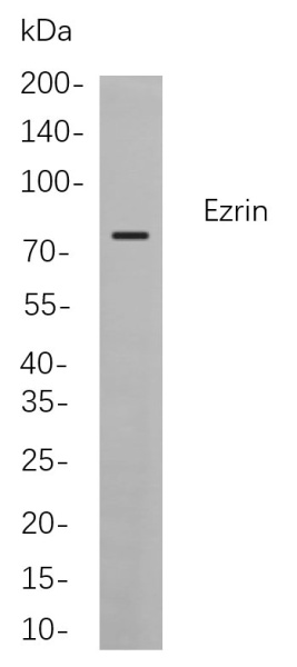 Recombinant Ezrin Monoclonal Antibody (AN300881L)