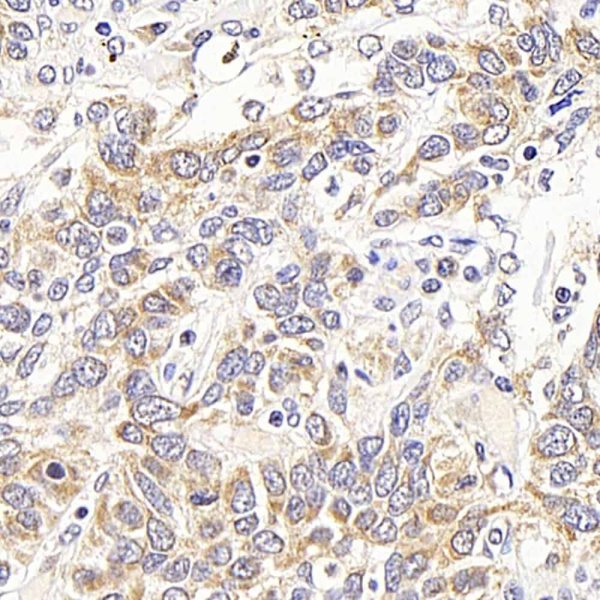 ATF2 Polyclonal Antibody (E-AB-70184)
