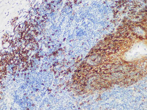 CD138 Monoclonal Antibody (ELAB6720-M)