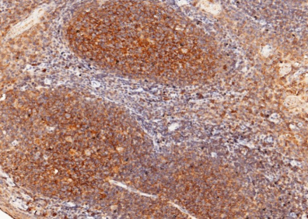CD82/KAI-1 Monoclonal Antibody (AN200127P)