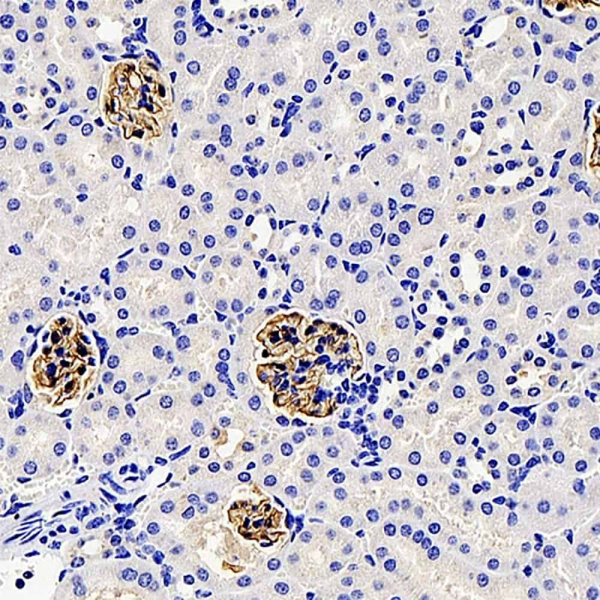 NPHS1 Polyclonal Antibody (E-AB-70211)
