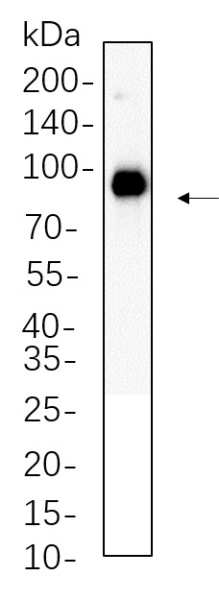 Recombinant FAP Monoclonal Antibody (AN301347L)