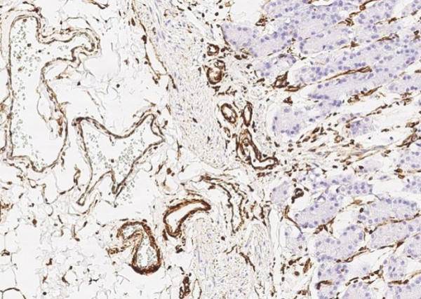 Recombinant Vimentin/VIM Monoclonal Antibody (AN300103P)