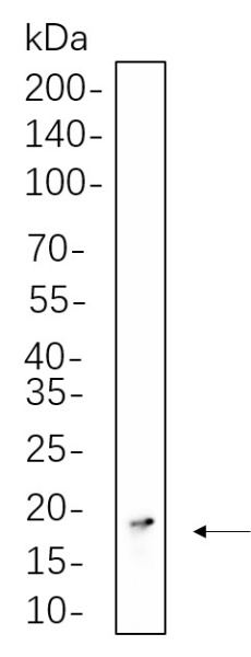 Recombinant Histone H3 (Tri Methyl Lys36) Monoclonal Antibody (AN301294L)