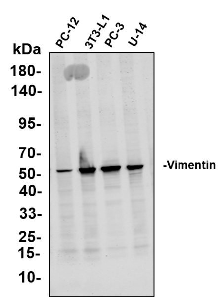 Recombinant Vimentin Monoclonal Antibody (AN300850L)