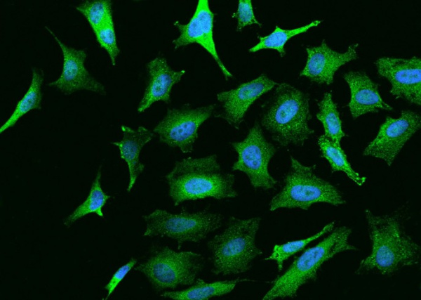 Recombinant NGFR Monoclonal Antibody (AN300436P)