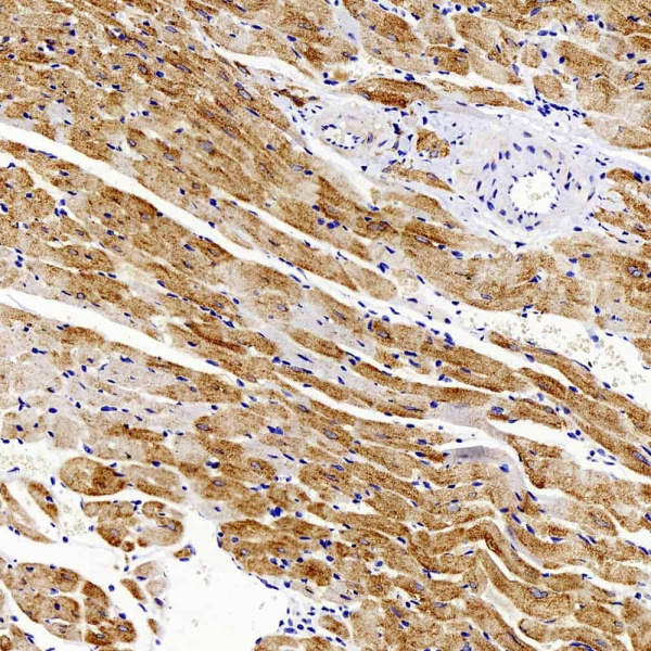 GLUT-4 Polyclonal Antibody (E-AB-70104)