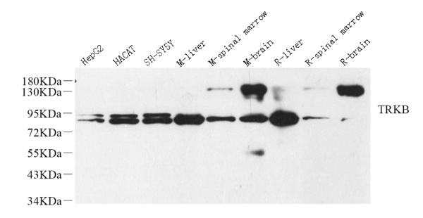 NTRK2 Polyclonal Antibody (E-AB-70155)