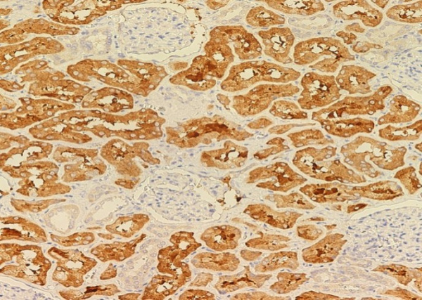 SSEA1/FUT4 Monoclonal Antibody (AN200086P)