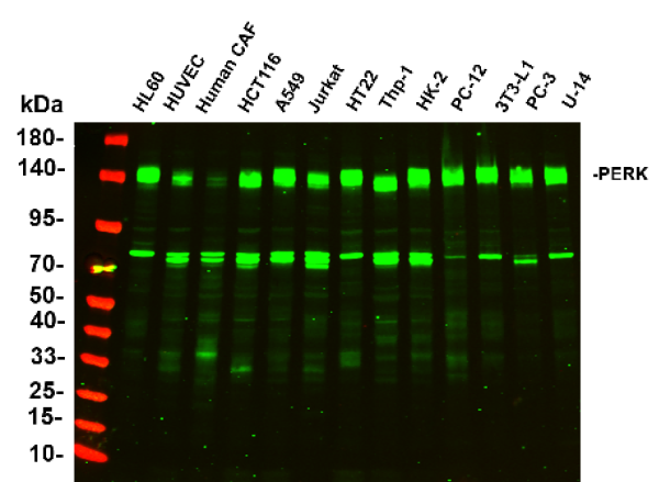 Recombinant PERK Monoclonal Antibody (AN301005L)