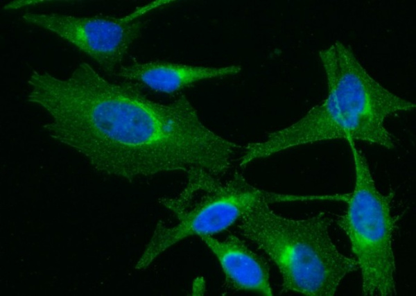 Recombinant B2M/beta-2 microglobulin Monoclonal Antibody (AN300019P)