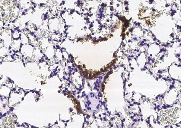 Recombinant Uteroglobin/SCGB1A1 Monoclonal Antibody (AN300504P)