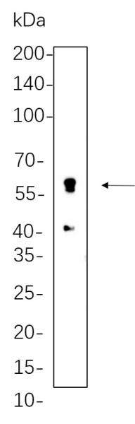 Recombinant Perilipin-1 Monoclonal Antibody (AN301360L)