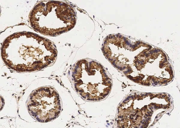 Recombinant CaM Kinase 4/CaMKIV Monoclonal Antibody (AN300564P)
