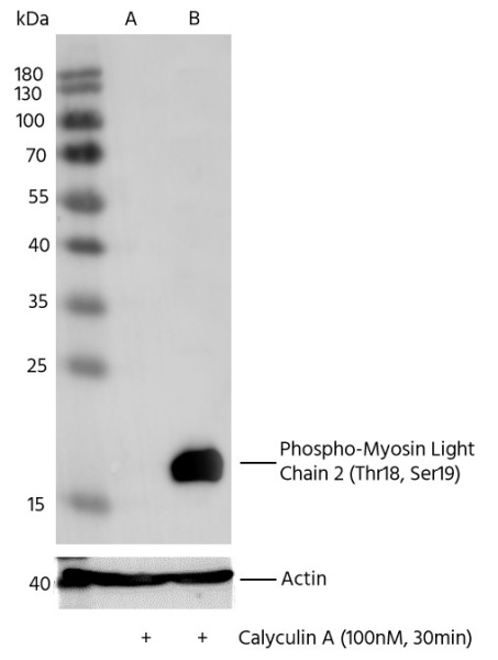Recombinant Phospho-Myosin Light Chain 2 (Thr18, Ser19) Monoclonal Antibody (AN300224L)
