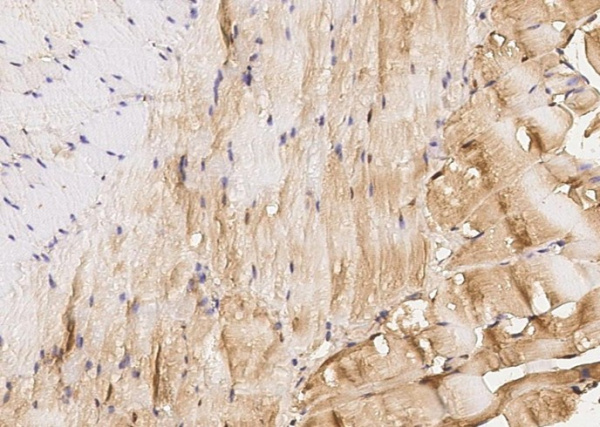 Recombinant IGFBP6/IBP6 Monoclonal Antibody (AN300520N)