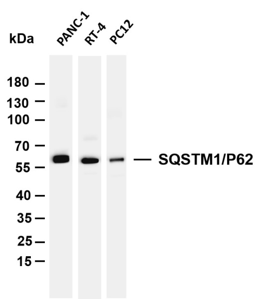 Recombinant SQSTM1/p62 Monoclonal Antibody (AN301383L)