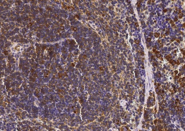 Recombinant CD62L/L-Selectin/SELL Monoclonal Antibody (AN300464P)