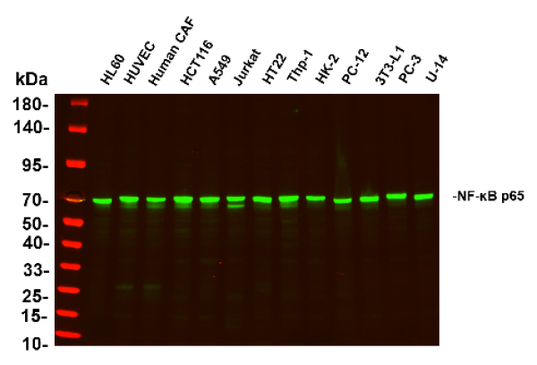 Recombinant NF-κB p65 Monoclonal Antibody (AN301374L)