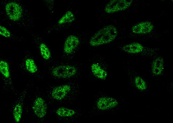 Brachyury/TBXT Monoclonal Antibody (AN200160P)